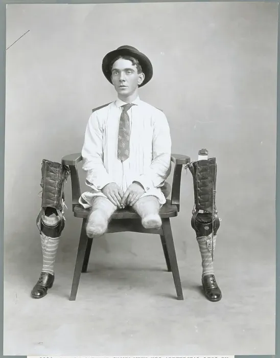 Framed Print : Portrait of a Legless Man Framed Print : Portrait of a Legless Man