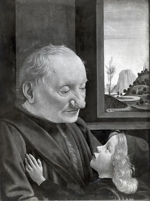 Framed Print : Portrait Of Man W / Nose Disease And Son Framed Print : Portrait Of Man W / Nose Disease And Son
