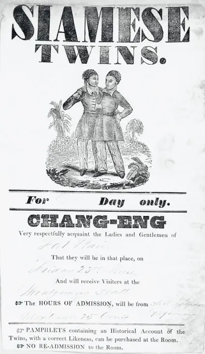 Framed Print : Poster Advertising Siamese Twins Framed Print : Poster Advertising Siamese Twins