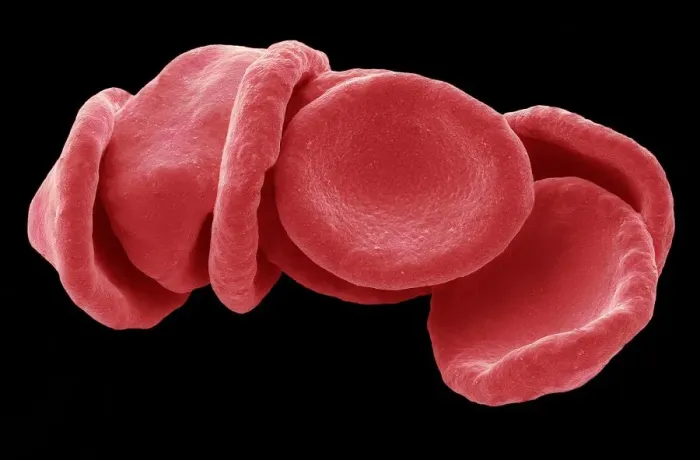 Framed Print : Red blood cells, SEM