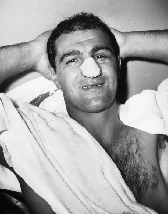 Framed Print : Rocky Marciano with Bandages Nose Framed Print : Rocky Marciano with Bandages Nose