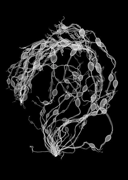 Seaweed (Ascophyllum nodosum), X-ray