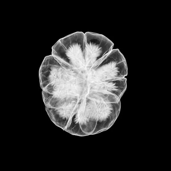 Seed head, X-ray