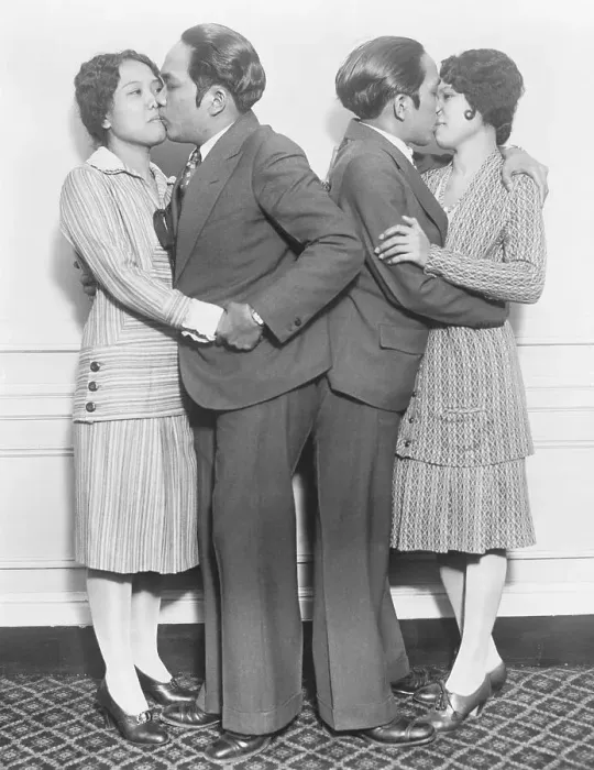 Framed Print : Siamese Twins Kissing Women Framed Print : Siamese Twins Kissing Women