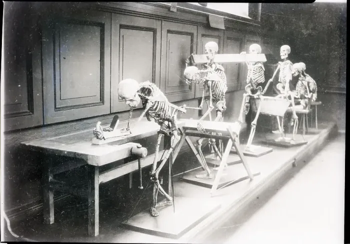 Framed Print : Skeletons Posed As If Laboring Framed Print : Skeletons Posed As If Laboring