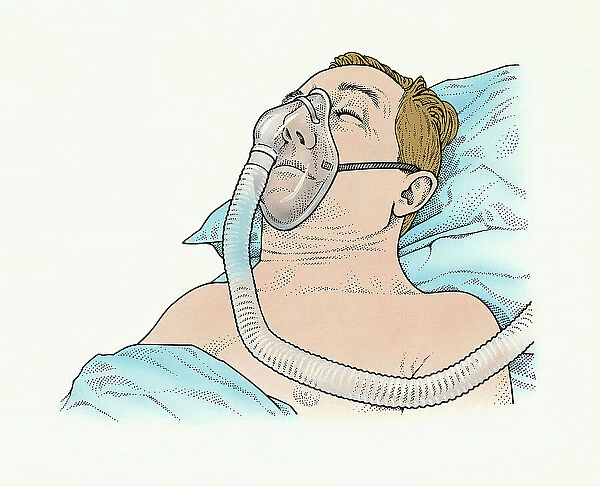 A sleep apnea patient with mask