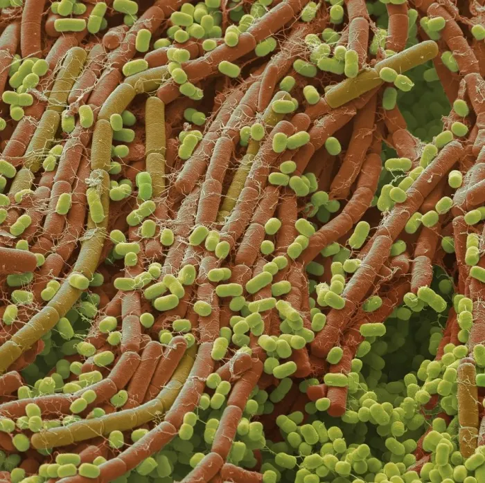 Framed Print : Soil bacteria, SEM Framed Print : Soil bacteria, SEM
