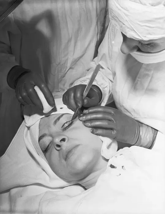 Framed Print : Surgeon Performing Eyelid Surgery on Woman Framed Print : Surgeon Performing Eyelid Surgery on Woman