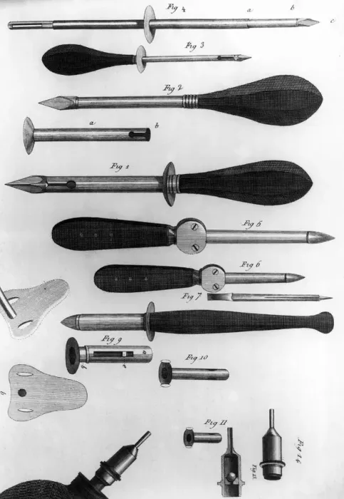 Framed Print : Surgical Trocars Framed Print : Surgical Trocars