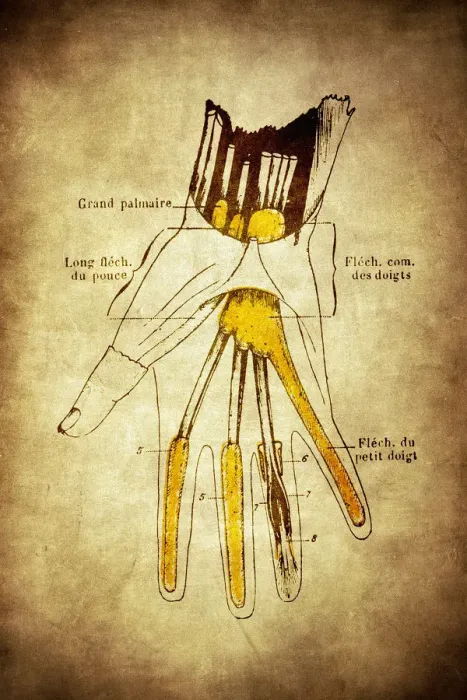 Framed Print : Synovial sheaths of wrist, palm and fingers Framed Print : Synovial sheaths of wrist, palm and fingers