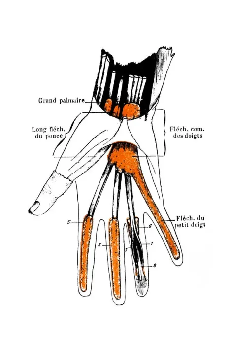 Framed Print : Synovial sheaths of wrist, palm and fingers Framed Print : Synovial sheaths of wrist, palm and fingers