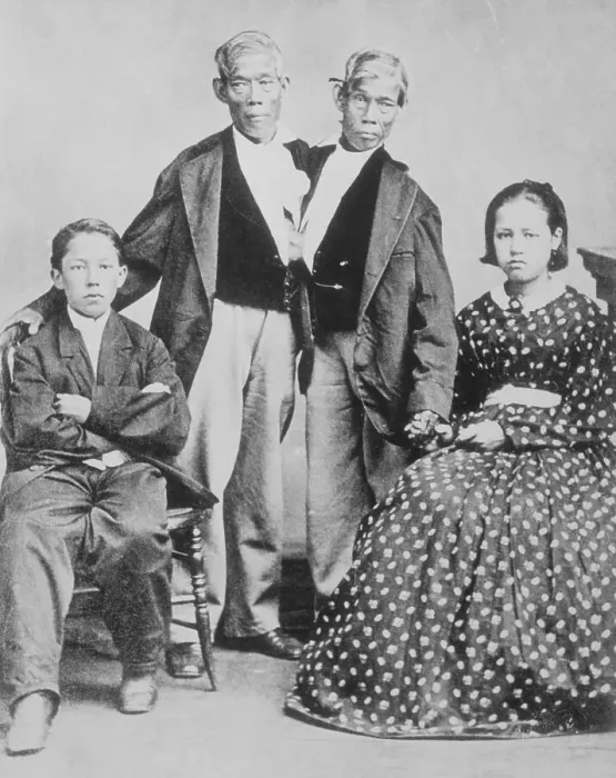Framed Print : Twins Chang and Eng with Two of Their Children Framed Print : Twins Chang and Eng with Two of Their Children