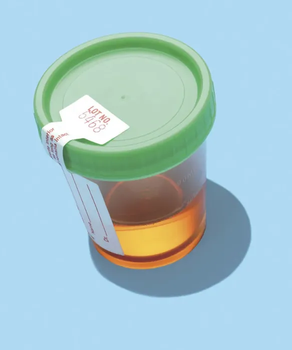 Framed Print : Urine Sample Framed Print : Urine Sample