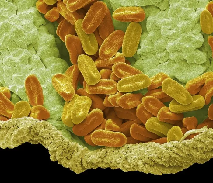 Framed Print : Verbena pollen, SEM Framed Print : Verbena pollen, SEM