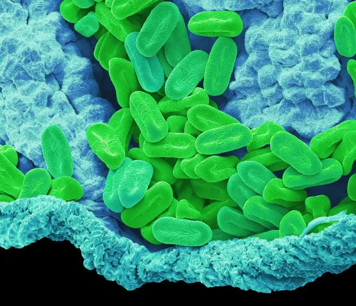 Framed Print : Verbena pollen, SEM Framed Print : Verbena pollen, SEM