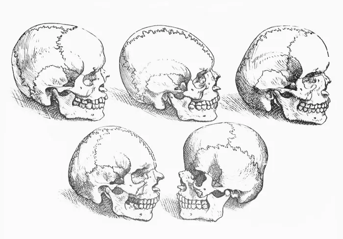 Framed Print : Vesalius Engraving Of 6 Human Skulls Framed Print : Vesalius Engraving Of 6 Human Skulls