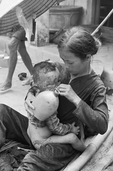 Framed Print : Vietnamese Mother Gives Burned Child Water Framed Print : Vietnamese Mother Gives Burned Child Water