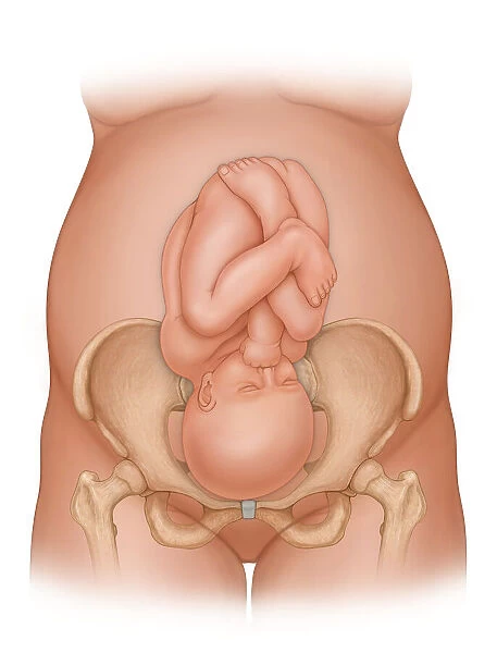 Front view of a woman nine months pregnant (baby phantomed within) ready for delivery