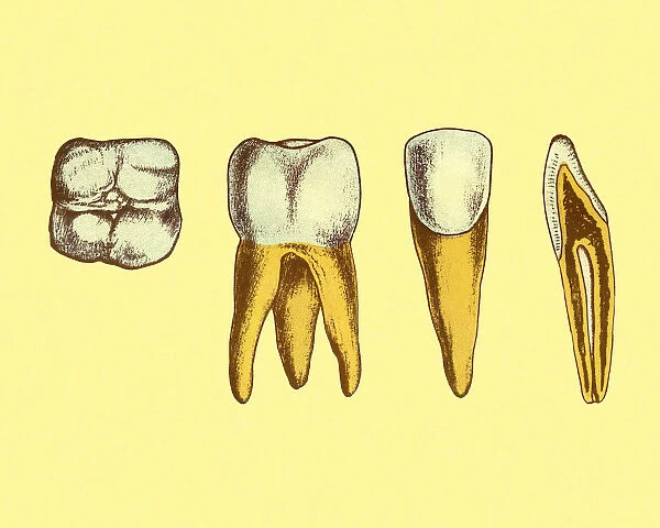 Four Views of Teeth