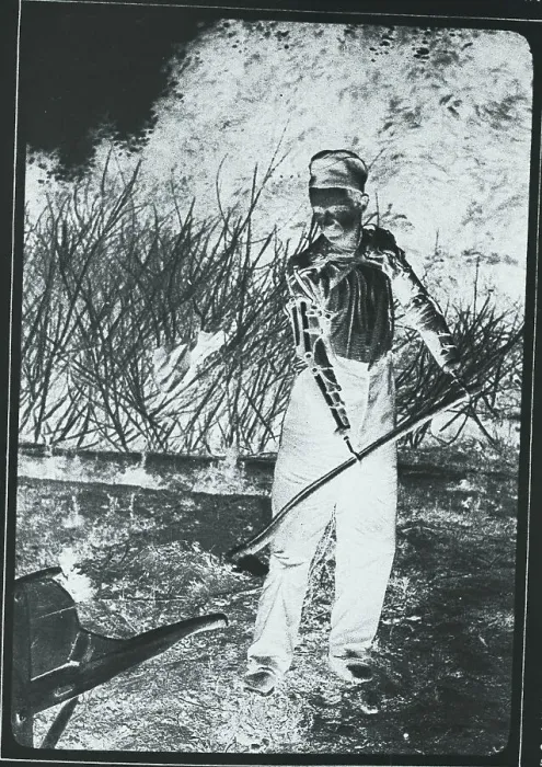 Framed Print : War Veteran Spading with Artificial Limbs Framed Print : War Veteran Spading with Artificial Limbs
