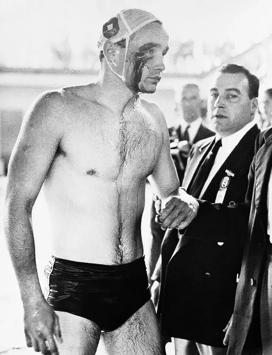 Framed Print : Water Polo Player Bleeding From Face Framed Print : Water Polo Player Bleeding From Face