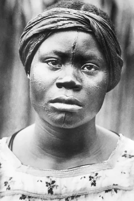 Framed Print : Woman Of Africa With Facial Scars Framed Print : Woman Of Africa With Facial Scars