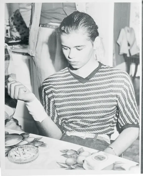 Framed Print : Woman Looking at Her Bandaged Wrist Framed Print : Woman Looking at Her Bandaged Wrist