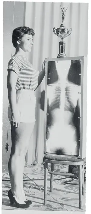 Framed Print : Woman Posing Next to Skeleton X-Ray Framed Print : Woman Posing Next to Skeleton X-Ray