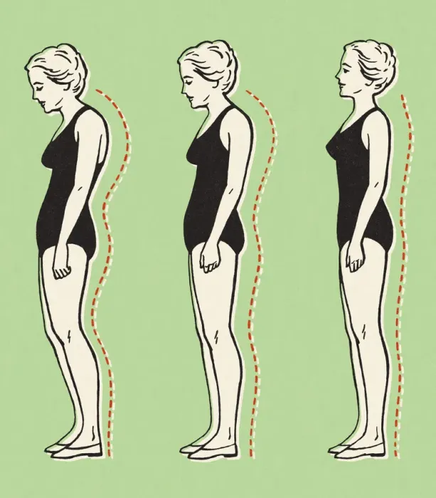 Framed Print : Woman Standing With Better Posture Framed Print : Woman Standing With Better Posture