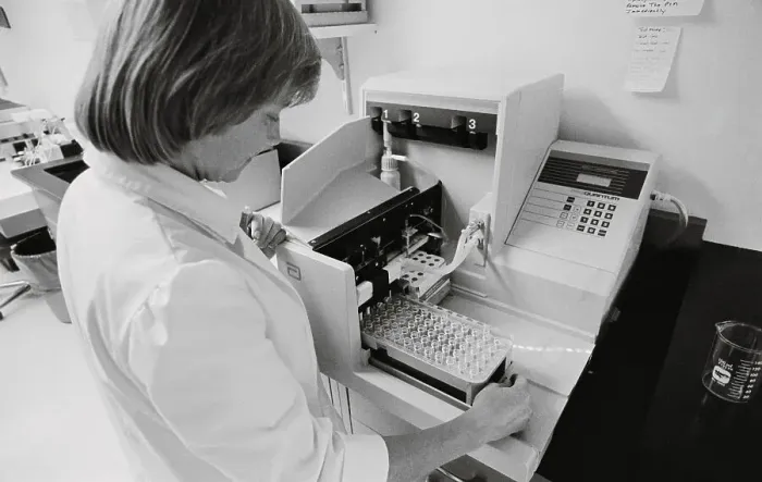 Framed Print : Woman Testing Blood for AIDS Antibodies
