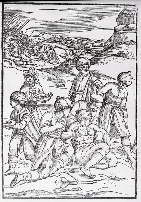 Framed Print : Woodcut of Doctor Cauterizing Wounded Soldier Framed Print : Woodcut of Doctor Cauterizing Wounded Soldier