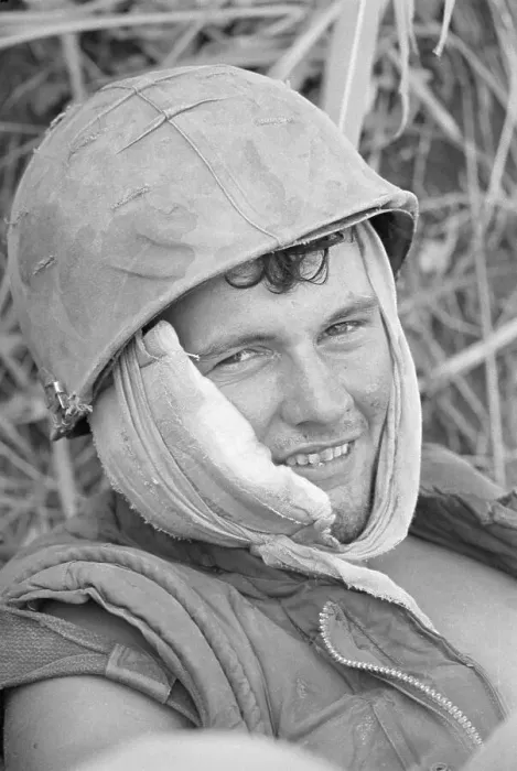 Framed Print : Wounded Marine Smiles Through Bandages Framed Print : Wounded Marine Smiles Through Bandages