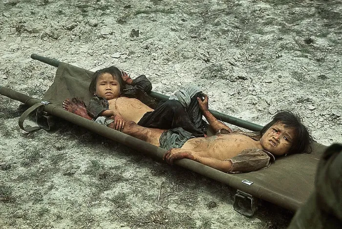 Framed Print : Wounded Vietnamese Children in Stretcher Framed Print : Wounded Vietnamese Children in Stretcher