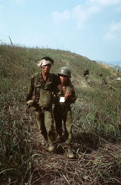 Framed Print : Wounded Vietnamese Soldier Walking
