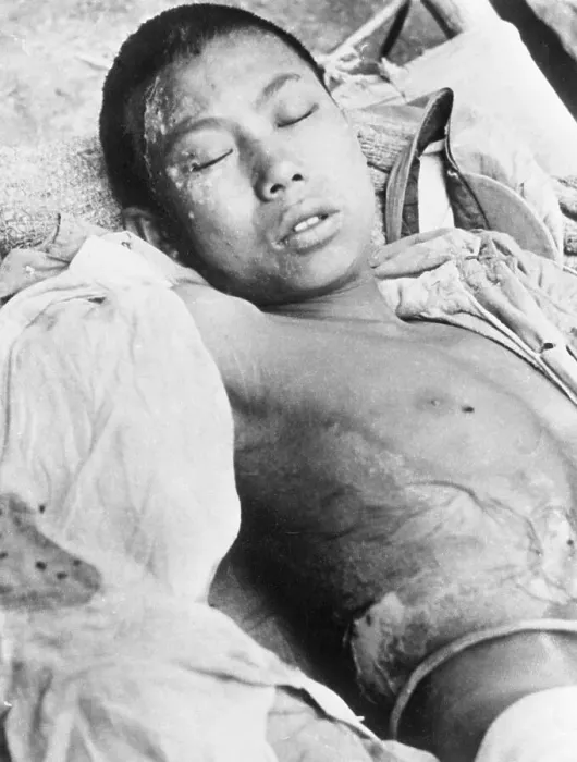 Framed Print : Wounded Young Chinese Machine-Gunner Framed Print : Wounded Young Chinese Machine-Gunner