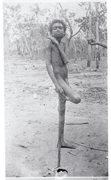 Framed Print : Young Australian Native Posing on One Leg Framed Print : Young Australian Native Posing on One Leg
