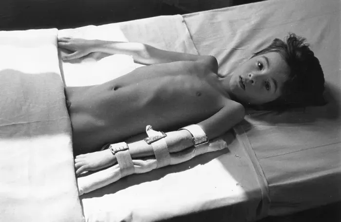 Framed Print : Young Patient Framed Print : Young Patient