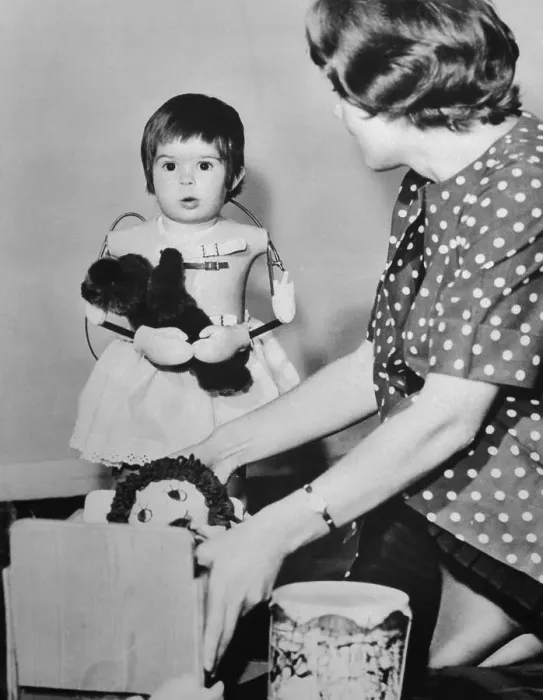 Framed Print : Young Toddler with Artificial Arms
