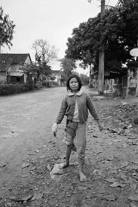 Framed Print : Young Wounded Vietnamese Girl Framed Print : Young Wounded Vietnamese Girl