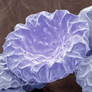 Bougainvillea pollen, SEM Bougainvillea pollen, SEM