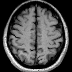 Brain MRI Print - Male Brain Artwork Brain MRI Print - Male Brain Artwork