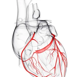 Coronary Arteries Print Coronary Arteries Print