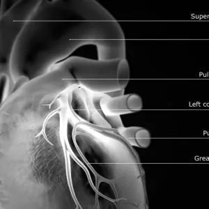 The coronary vessels of the heart The coronary vessels of the heart