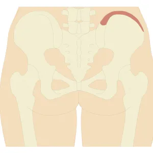 Cross section biomedical illustration of iliac crest site on pelvis