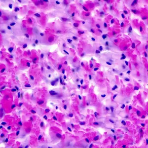 Dense Connective Tissue, 40x light micrograph