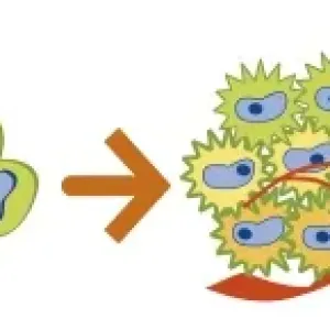 Digital illustration of the evolution of a cancer from initiation to metastasis