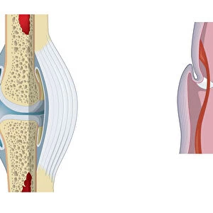 Digital illustration of invertebrate joint, left, and vertebrate joint, right