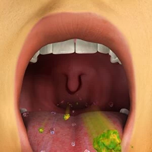 Digital illustration showing cough reflex action through open mouth