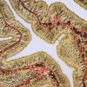 Fallopia tube, LM Fallopia tube, LM