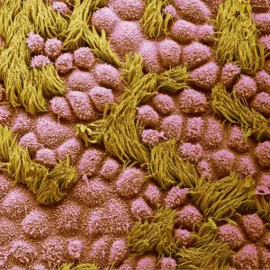 Fallopian tube, SEM Fallopian tube, SEM
